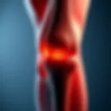 An anatomical diagram of the knee joint highlighting osteoarthritis