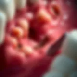 A close-up view of periodontal tissues affected by disease