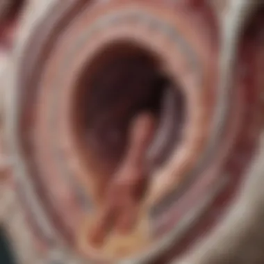 Anatomical Overview of the Bladder and CIS Diagram illustrating the anatomy of the bladder and carcinoma in situ localization