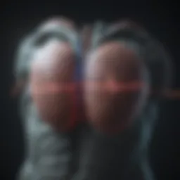 ECG depicting Brugada pattern