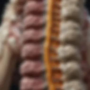 Anatomical Sites of Calcium Deposits in the Spine Illustration of calcium deposit locations in the spine
