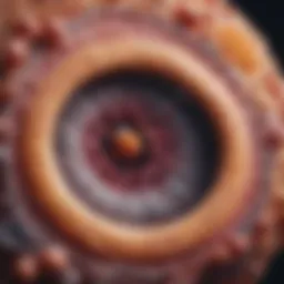 Microscopic view of carcinoma in situ cells in the bladder