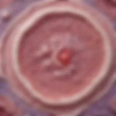 Histopathology of Colloid Carcinoma Histopathological slide of colloid carcinoma showing mucin production