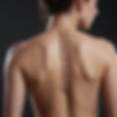 A detailed diagram illustrating scoliosis curvature