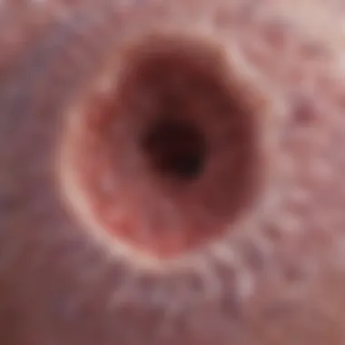 Detailed Microscopic Examination of Cutaneous SCC in Situ Microscopic view of cutaneous squamous cell carcinoma in situ