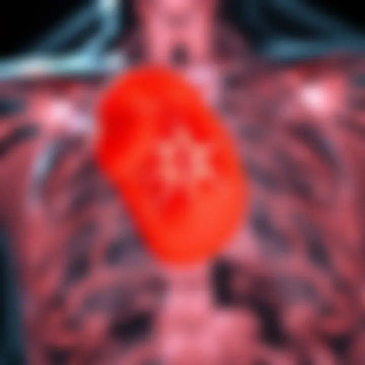 Notable Metastasis of Squamous Cell Carcinoma to Lymph Nodes: An In-Depth Examination Notable Metastasis of Squamous Cell Carcinoma to Lymph Nodes: An In-Depth Examination