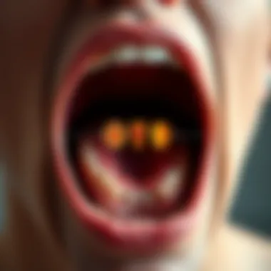 Stages of Oral Cancer Development Diagram illustrating the stages of oral cancer development