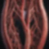 Illustration of narrowed arteries in peripheral artery disease