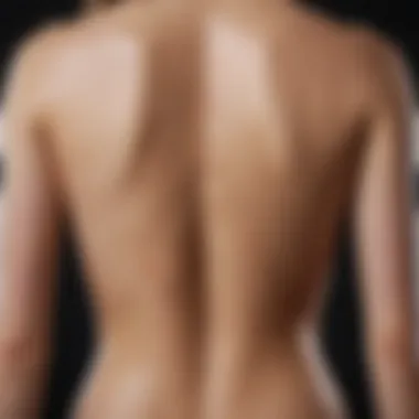 Long-Term Outcomes Post Scoliosis Surgery Chart showing long-term outcomes post scoliosis surgery