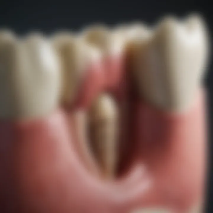 Diagram illustrating techniques for effective tooth remineralization