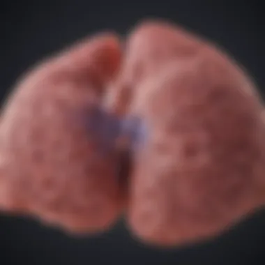 Staging of Small Cell Lung Cancer Diagram illustrating SCLC staging