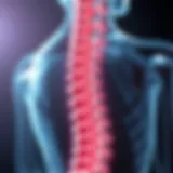 Illustration depicting the anatomy of the spine affected by bone cancer