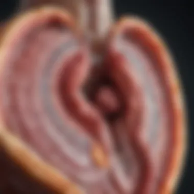 Diagram illustrating the spectrum of acute coronary syndromes.