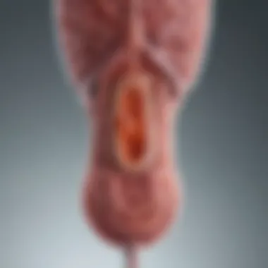 Diagram illustrating urinary tract infection Diagram illustrating urinary tract infection