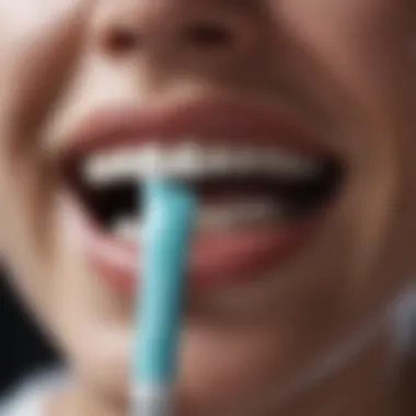 Fluoride in Decay Prevention Diagram illustrating how fluoride toothpaste prevents decay