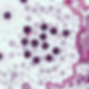 Micrograph showing Hurthle cells in thyroid tissue