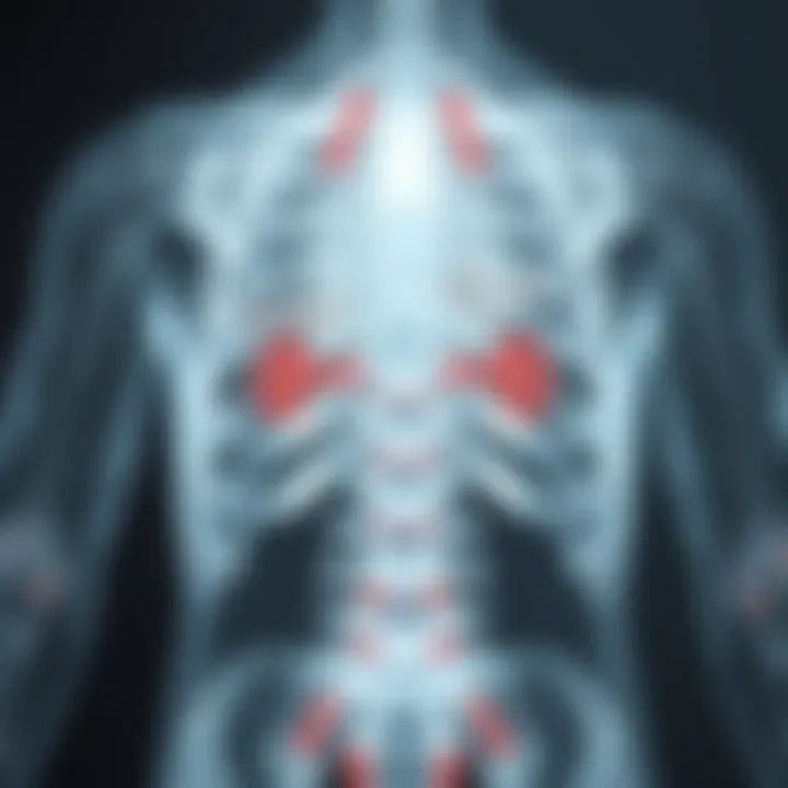 Pathways of Metastasis to Bones Diagram illustrating the pathways of kidney cancer metastasizing to bones