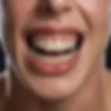 Illustration depicting the stages of periodontitis progression