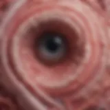 Histological view of eosinophilic infiltration in the esophagus
