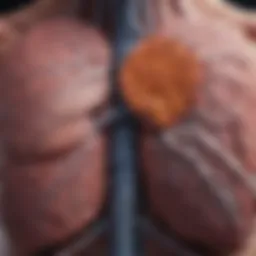 Visual representation of pulmonary sarcoidosis stages