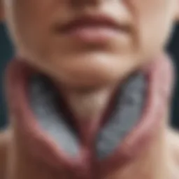 Illustration of a thyroid gland with nodules highlighted